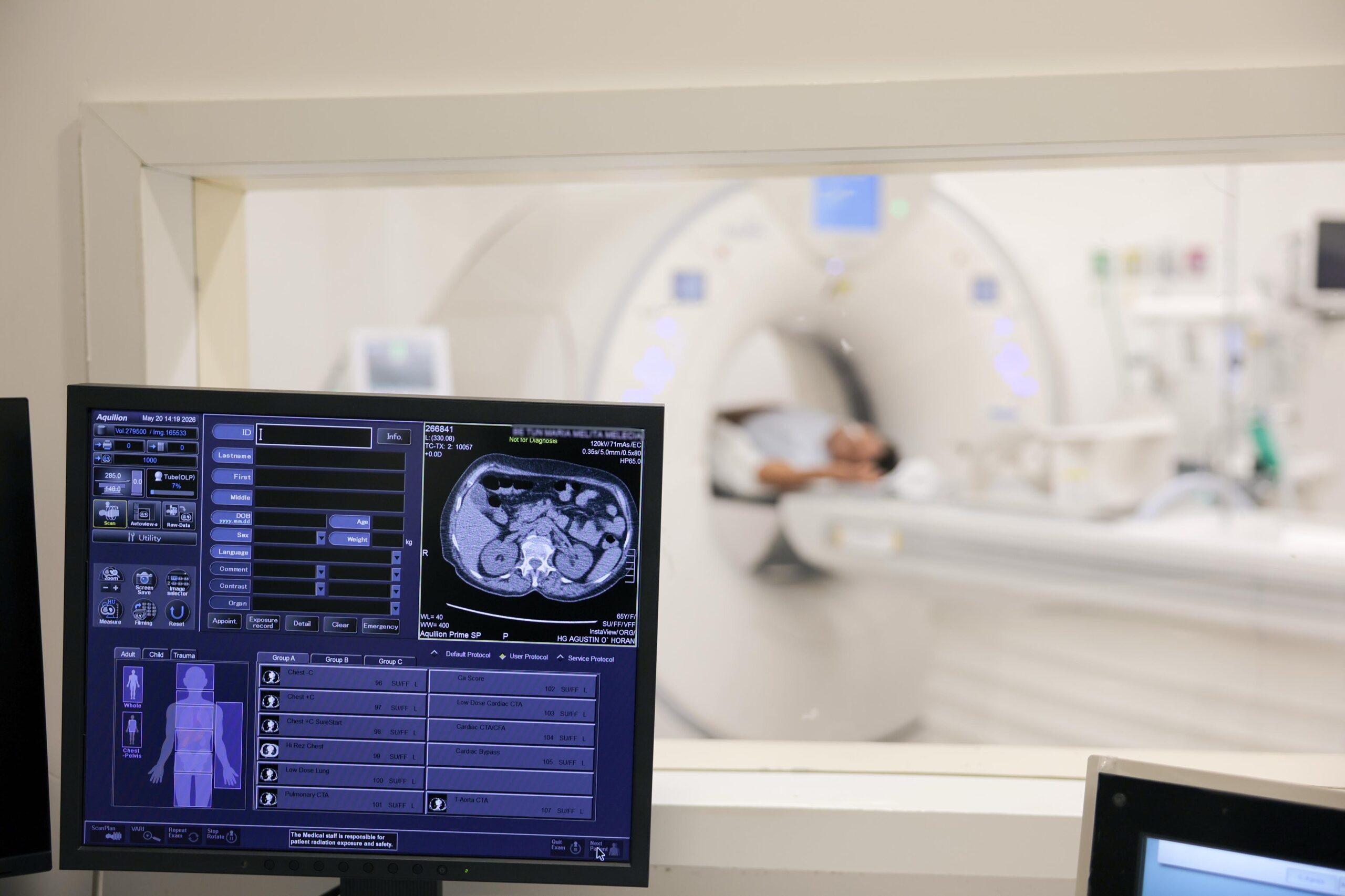 Nuevo Hospital O’Horán fortalece diagnósticos médicos con tomógrafo de última generación Nuevo Hospital O’Horán fortalece diagnósticos médicos con tomógrafo de última generación